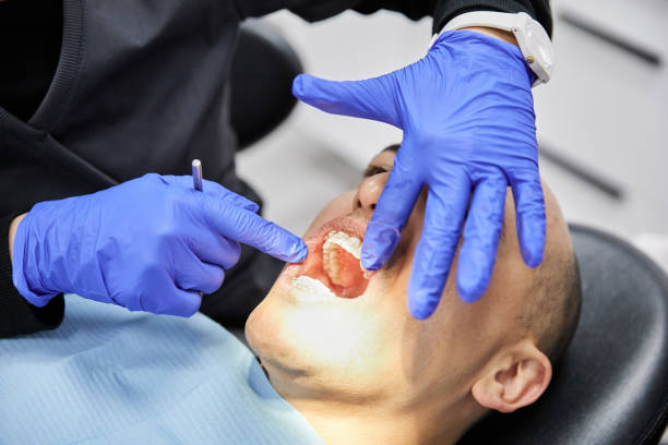 Best Emergency Dental Care for Broken or Chipped Teeth in West Point, UT